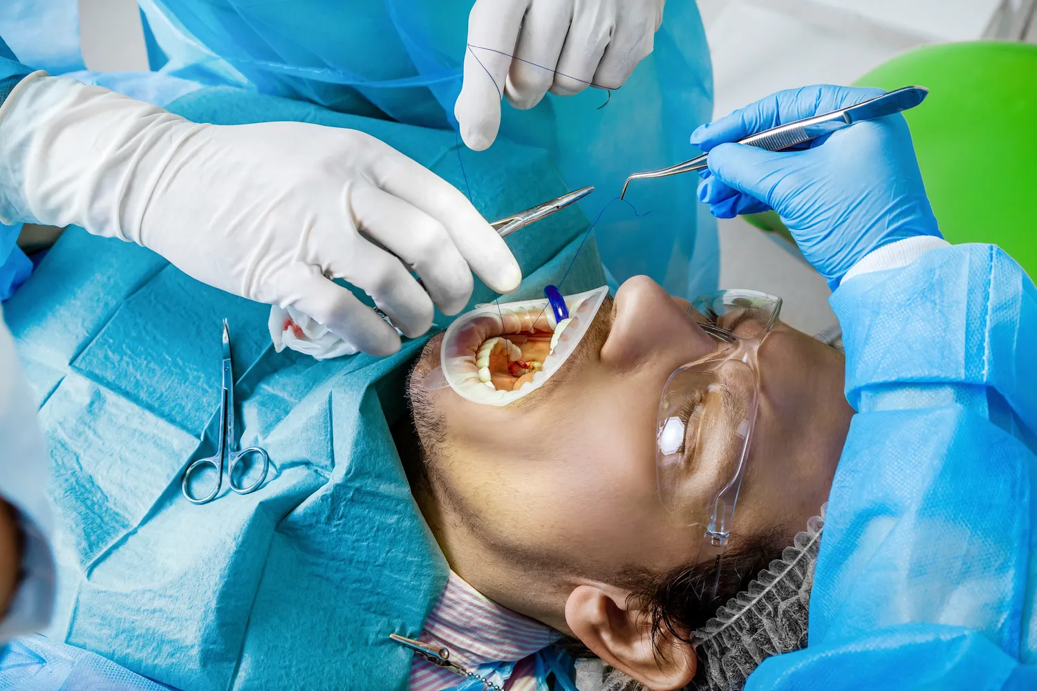 E recepta jaki czas realizacji?